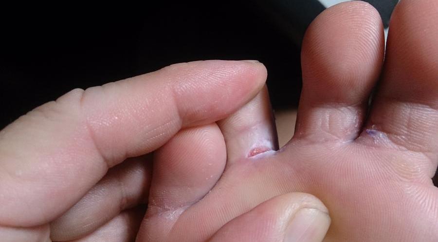 پای ورزشکار